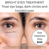 SEPT 26 VIP DEAL - BRIGHT EYES TREATMENT - ANTI-AGING EYE LIFTING FOR YOUR EYES