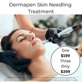 OCT 26 - Dermapen Skin Needling Treatment