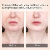 FACE & NECK LIFTING DEVICE WITH EMS & LED