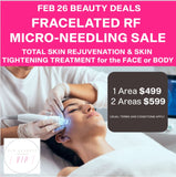 FEB 26 VIP SALE - Fracelated RF Micro-Needling Treatment