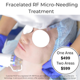 OCT 26 - Fracelated RF Micro-Needling Treatment