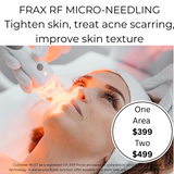 SEPT 26 VIP DEAL - Fracelated RF Micro-Needling Treatment