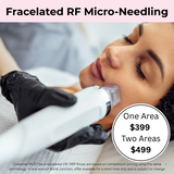 AUGUST 26 DEAL - Fracelated RF Micro-Needling Treatment