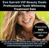 JUNE VIP OFFER - Professional Teeth Whitening Treatment