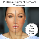 OCT 26 - PICOmax Pigment Removal Treatment (Treat Dark Spots, Age Spots & Pigment)