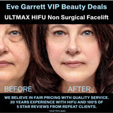 JULY 26 VIP OFFER - 'ULTMAX' HIFU Non Surgical Facelift