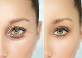 SEPT 26 VIP DEAL - BRIGHT EYES TREATMENT - ANTI-AGING EYE LIFTING FOR YOUR EYES